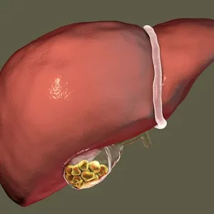 Liver and Gallbladder with stones Charlotte Acu Bodywork