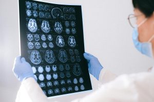 Doctor holding images of the brain